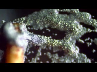 removing the dolsk  under microscope